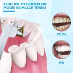 DEN-T® PRO P350 Elektrische Tandenpolijster - Wit - 5 Standen - 5 Opzetstukken - Polijstmachine - Polijstset - Tanden Polijsten - -Modecosmetica 1200x1200 298